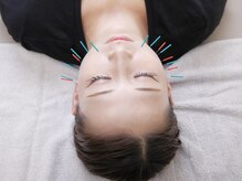 ネイビー鍼灸指圧治療院(NAVY鍼灸指圧治療院)/『乾燥肌対策に美容鍼』