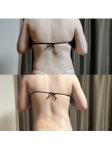 スリール(sourire)/ビフォーアフター