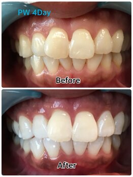 ドクターモック(Dr.MOC)/ＢＥＦＯＲＥ→ＡＦＴＥＲ
