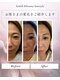 トータルビューティー筋膜ケアサロン カンスタイル(Kanstyle)の写真/【美肌×脱毛】最先端IPL脱毛！毛穴引き締め＆美白ケアでツルツル美肌へ★都度払いOKで自分のペースで◎