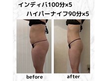 レディエンス(Radiance)の雰囲気（大幅なダイエットもご相談下さい◎）
