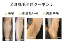 ラナ ビューティー(LANA beauty)