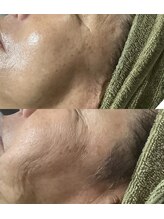 サザンベル(Southern Belle)/ACトリートメント