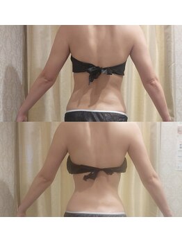 マイフェアレディ 今池(MyFairLady)/温活エステ☆ラフォス高周波