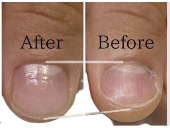 ブルームブルーム(BLOOMブルーム)/ビフォーアフター