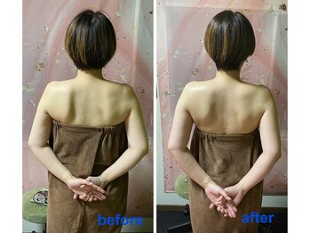 グラムール/肩甲骨の可動域