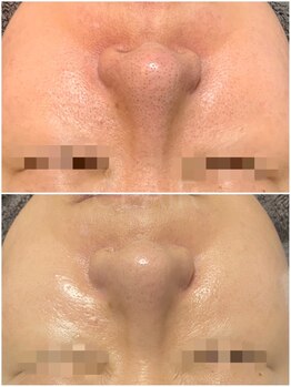 クレール(CLAIR)/40代後半のお客様