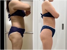 シルク ド ココ(Silk de Coco)/リジュスキャルプ+全身整体