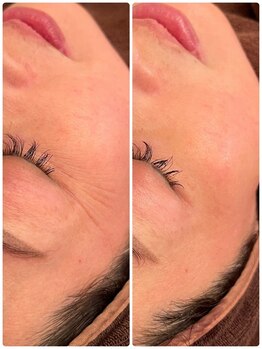 ジョルジオ東京/リジュラン導入