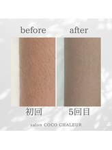 ココ シャルール(salon COCO CHALEUR)/Before　After
