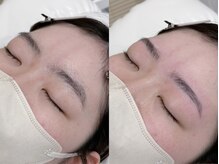 アッベリーレベッラ(A'bbellire Bella)/ハリウッドブロウリフト