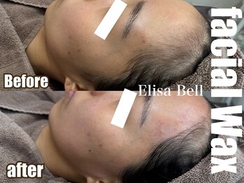 エリーザベル(Elisa Bell)/ツヤ肌フェイシャルワックス脱毛