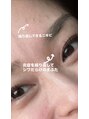 マヨズサロン(MAYO's salon) 敏感肌から来るニキビ・毛穴・乾燥・赤み・シワ、改善できました