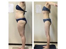 美ボディラボ(美Body Labo)の雰囲気（痩身効果の最新マシンを導入♪独自の燃焼ハンドとSET体験）