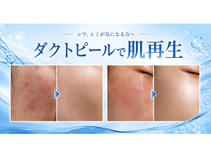 アオイ(Aoi)の写真
