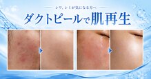 アオイ(Aoi)