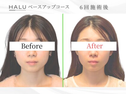 ハル(HALU)の写真
