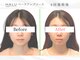 ハル(HALU)の写真