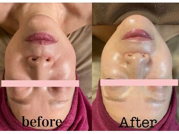 コティーバイホイヤ(Cotty by HOIYA)/◎タラソトリートメント1回