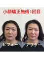 オズ六本木&nbsp;小顔矯正/小顔マッサージ/小顔調整/小顔/矯正/コルギ/ヘッドスパ