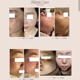 セカンド バイ サムデイ(SECOND by someday)