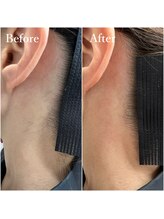 ホワイトワックス 京都四条烏丸(WHITE WAX)/うなじワックス