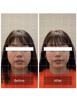 蒼月(aotsuki)/Before/After