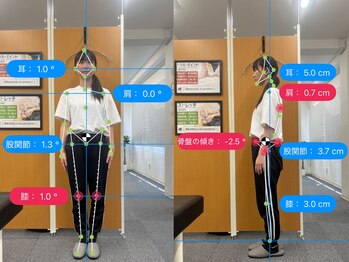 ナオル整体 大阪茨木院(NAORU整体)/【AI　姿勢　分析】整体・茨木