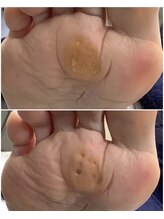 リゼラアンドコー 盛岡店/ドイツ式フットケア専門店