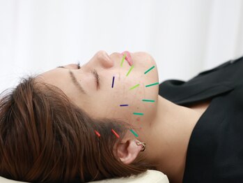 アロエベル(aloe Belle)/美容鍼