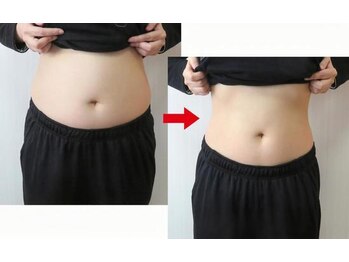 キヨラビューティー/部分ケア