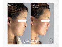 サロン シェリール(Salon Cherir)の雰囲気(たるみ撲滅!眠れるほど痛みが少ない《小顔調整》が人気です♪)