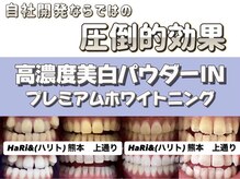 ハリト 熊本 上通り水道町(HaRi&)の雰囲気(高濃度プレミアムパウダーIN☆ホワイトニングで効果絶大!)