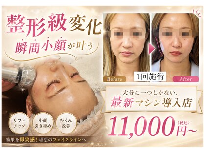 ナナイロ(nanairo)の写真