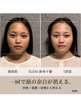 エレーニ 麻布十番(ELENI)/お悩みしていた左右差が整えた