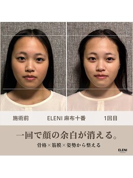 エレーニ 麻布十番(ELENI)/お悩みしていた左右差が整えた