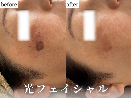 ぺルラ 島田駅前店(Perla)の写真