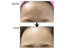 ウニ(uni)/【オーダーメイド肌管理】