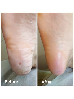 リゼラアンドコー 盛岡店/ドイツ式フットケア専門店