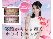 ホワイトニングショップ 宮崎店