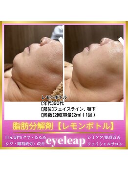 アイリープ(eyeleap)/