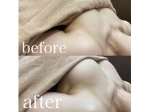 ディーソワン(De-soin)の雰囲気（【エステ】大人気バストアップケア◎３カップUPの実績あり！！）