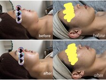 温活&美肌管理サロン su:su 福岡糟屋【よもぎ蒸し/毛穴/小顔/シミ/シワ】