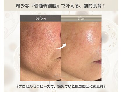 ラグラス(Laglace)の写真
