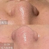 メグリス(Meglys)