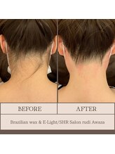 ルディ 阿波座店(rudi)/うなじ ワックス脱毛