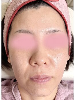 リフティングラボ(LIFTING LAB)/バイオセルショット65