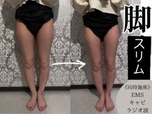 バロビュティー(BARO beauty)/