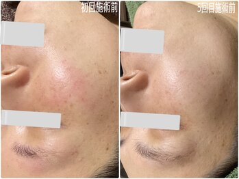 ブライトリー(Brightly)/なりたい素肌を作ります!