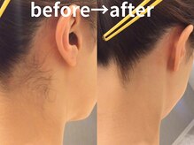 ももとゆでたまご/うなじビフォーアフター/新宿